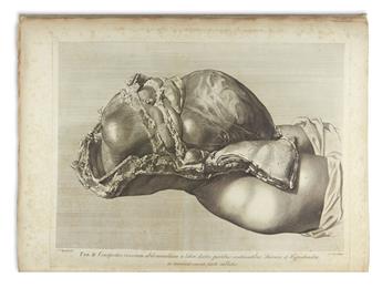 HUNTER, WILLIAM. Anatomia uteri humani gravidi . . . The Anatomy of the Human Gravid Uterus.  1774.  Lacks dedication leaf.